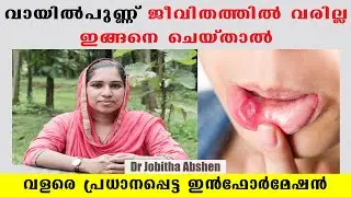 വായിൽ പുണ്ണ് വരാതിരിക്കുവാനും അഥവാ വന്നാൽ പൂർണ്ണമായും മാറാനും സിമ്പിൾ ട്രിക് /Baiju's Vlogs