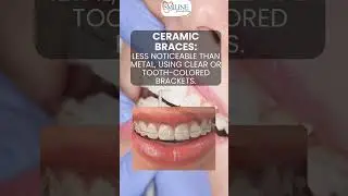 Flash Your Perfect Smile: The Ultimate Guide to Braces!  #dentalcare #smiledentist