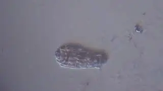 Stagnant water under microscope