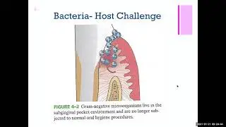 DNH 146  Chapt 4 Bacterial Host Response