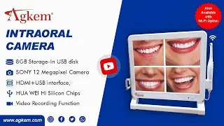 🚀 Agkem Intraoral Camera – High-Resolution Dental Imaging for Precise Diagnosis! 🦷📸