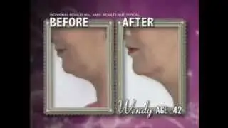 Neckline Slimmer Commercial - AS SEEN ON TV -