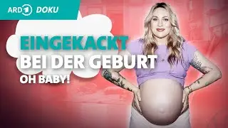 DAS passiert fast jeder Frau bei der Geburt #shorts