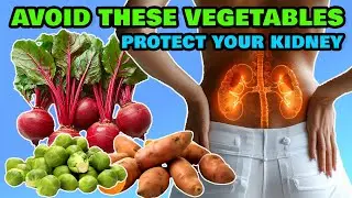 Top 10 Vegetables You Should Avoid To Protect Your Kidney Health