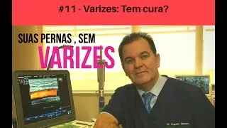 11- VARIZES: TEM CURA?