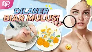 WAJIB COBA! Cara Cepat Menghilangkan Bekas Jerawat yang Hitam