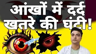 आंखों में दर्द? कारण, लक्षण और इलाज | Eye Pain Causes & Treatment in Hindi&rdquo;#Eyeache #eyes#motivation