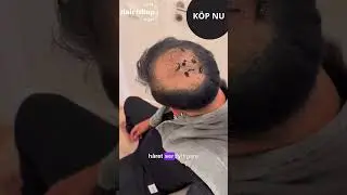 Hairfillup hair concealer