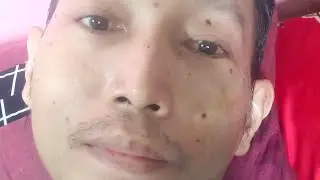Sharing tentang pengalaman sakit pasca operasi ambeien dan timbul penyakit baru yaitu kantung kemih