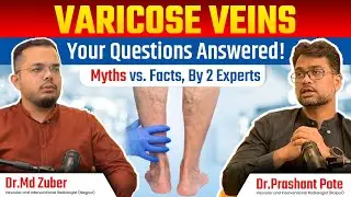 Varicose Veins: Evidence-Based Answers to Common doubts, treatment choices with real life stories. 