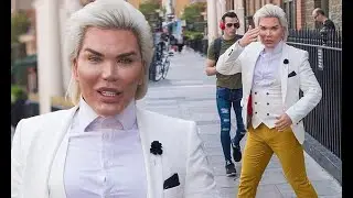 Human Ken Doll EXCLUSIVE: Rodrigo Alves reveals career plan in Milan - 247 News