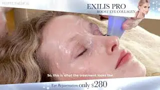 The Best Eye Rejuvenation Treatment!