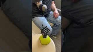 Team Tillges Myoelectric Upper Limb Fabrication