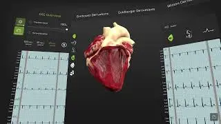 Insight Heart &ndash; EKG &ndash; ANIMA RES &ndash; 3D medical animation   AR   MR   VR og 5 sider til &ndash; Profil 2 &ndash; Mi