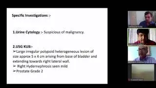 Muscle Invasive Bladder Carcinoma || FCPS Part 2 Urology Viva Practice || Urology ||
