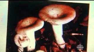 Experiment on Telepathy and Distant Healing - Ganzfeld Test