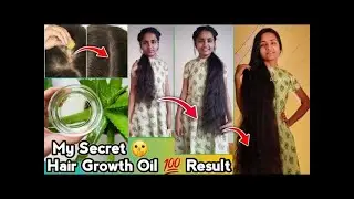 Busy & Lazy Girls' Faster Hair Growth Hack | Use Aloe Vera To Get Stronger longer Hair | RuntiMe