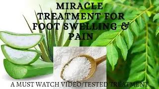 Natural Swollen feet treatment /Foot Pain Relief/Complete Foot Treatment/Saniyo Vlogs