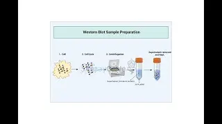 Guide to Western Blot Sample Preparation