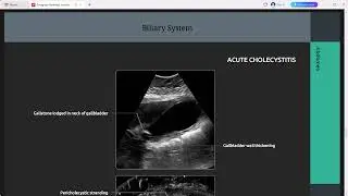 CHEST ABDOMEN IMAGING  ANATOMY