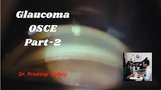 Glaucoma OSCE part 2 # Glaucoma diagnosis and management # Ophthalmology # PG Teaching program