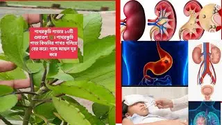 পাথরকুচি পাতার ১০টি রোগের ঔষধী গুনাগুণ। পাথরকুচি পাতার উপকারীতা ও ক্ষতি