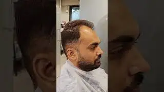 Front hair patch for men | Get Confidence with a Natural-Looking Front Hair Patch for Men #shorts