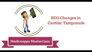 ECG Changes in Cardiac Tamponade   Electrical Alterans