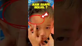 Aduh Keizo main koq sampe benjol gini sih ⁉️