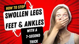 How to Stop Swollen Legs & Ankles ??