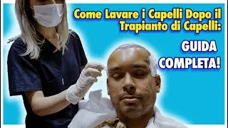 COME LAVARE I CAPELLI DOPO UN TRAPIANTO DI CAPELLI | GUIDA COMPLETA!