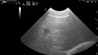 ECHINO SAFE MED Ultrasound examination