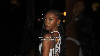 The BEST African American Rhinoplasty 👃🏾✨