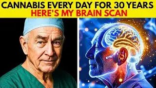 I Smoked Cannabis Every Day for 30 Years - Here's My Brain Scan