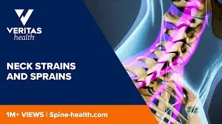 Neck Strains and Sprains