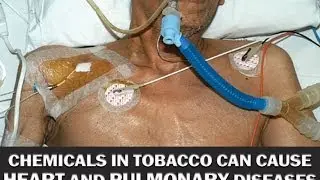 Manila: graphic health warnings sa cigarettes