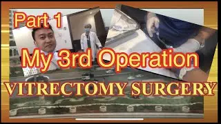 Part 1 |  Vitrectomy Surgery | Before and After Surgery | Aithan Official