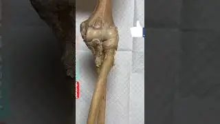 Elbow joint, #shorts  #elbow joint pain, elbow joint pain relief exercises, elbow joint bd chaurasia