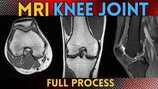 MRI knee joint planning and filming technique full tutorial | SIEMENS MRI |