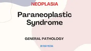Paraneoplastic syndromes / Neoplasia / General Pathology / Pathology.