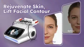 Anti-Aging Program at Beauty Salon: Single-Pole Radio Frequency | Model: SR-RF202