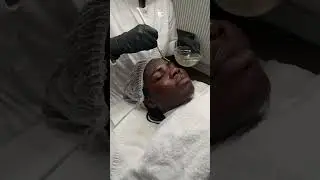 BIO PEELING