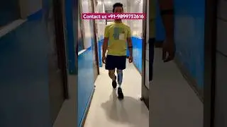 #artificiallimb #naturalwalk #legprosthesis #belowkneeamputee #belowkneeprosthesis