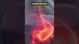 Tiny Cells Controlling Your Digestion &ndash; Gut Pacemaker