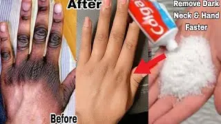 How to Make Your Hands Look 5 Years Younger Overnight! Wrinkle-free smooth fair hands