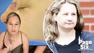 Gypsy Rose puts nose job on display in new photos, says &lsquo;the boogers are insane&rsquo; post-surgery