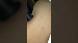 neck pain improvement with hypervolt