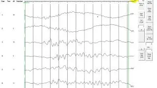 Cross hole data analysis