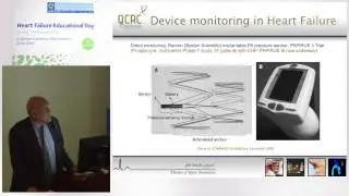 Magdi Yacoub - Device monitoring in Heart Failure