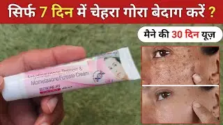 Elosone ht cream review | elosone ht cream | elosone ht cream use kaise kare 
